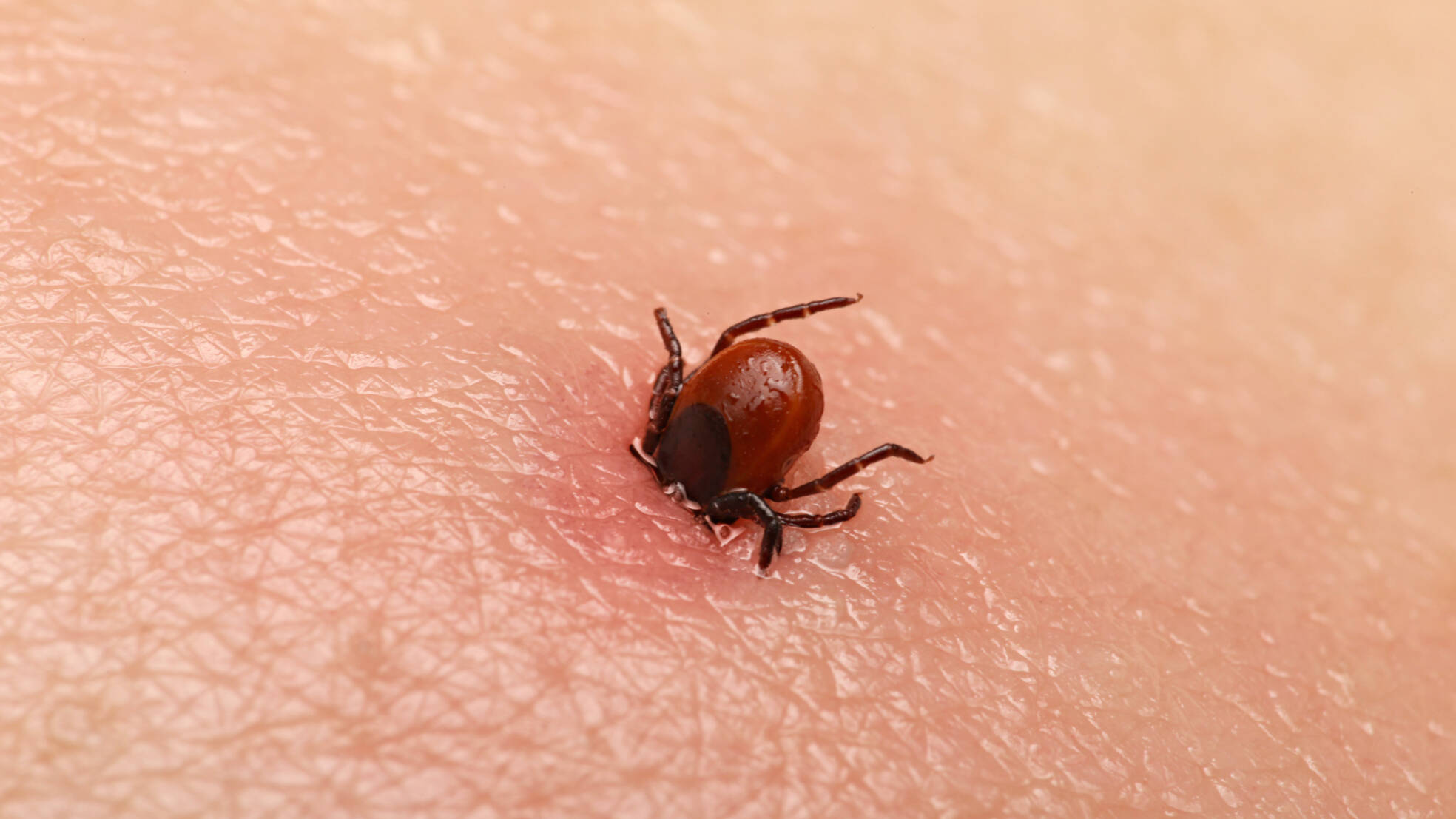 Tick